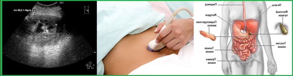 узи брюшной полости