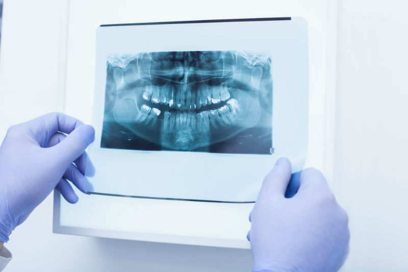 прикусный рентген